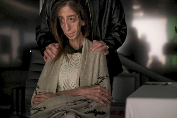 Lizzie Velasquez