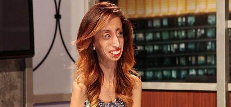 Lizzie Velasquez