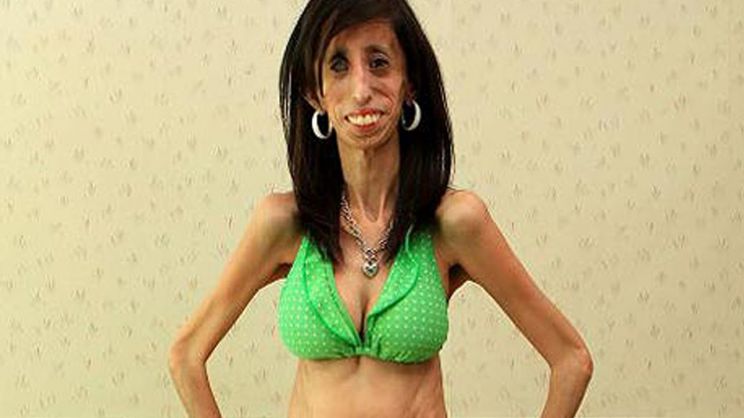 Lizzie Velasquez