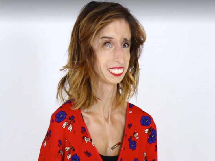 Lizzie Velasquez