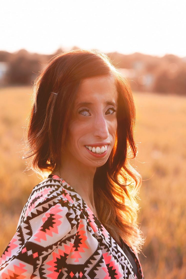 Lizzie Velasquez