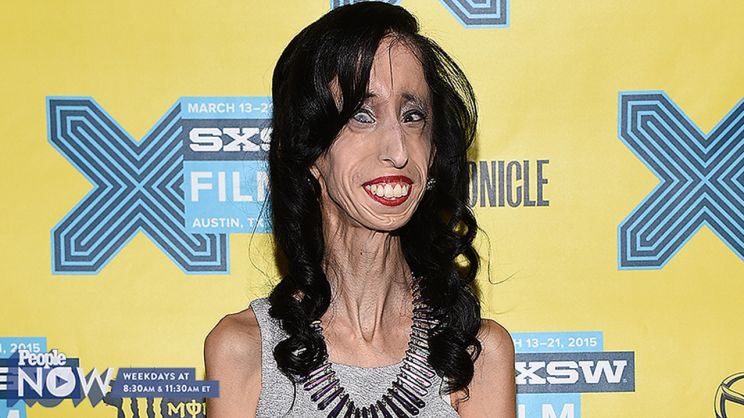 Lizzie Velasquez