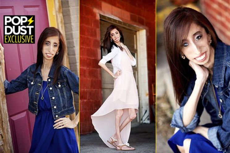 Lizzie Velasquez