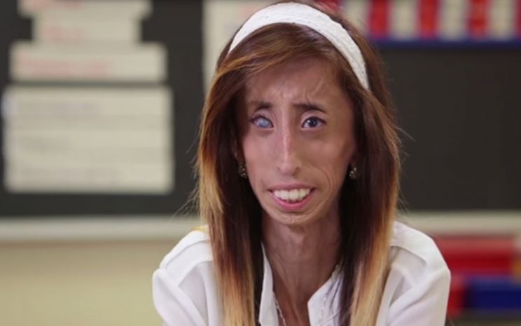 Lizzie Velasquez