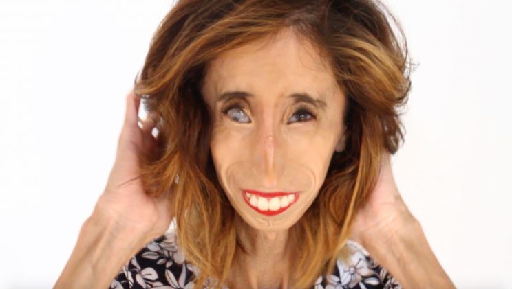 Lizzie Velasquez