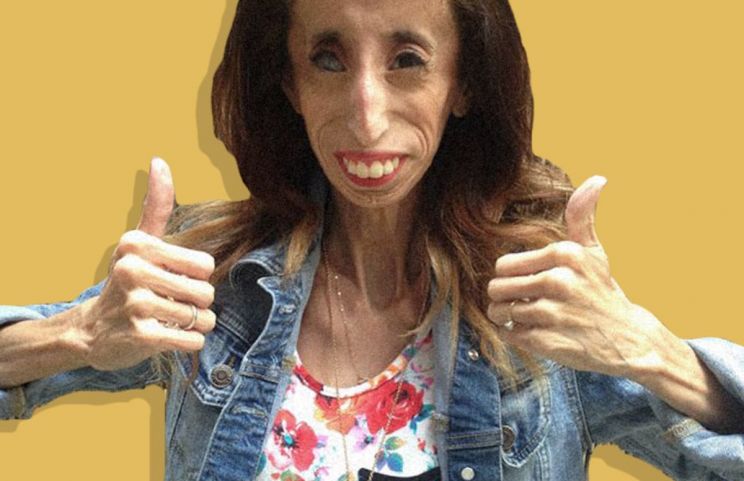 Lizzie Velasquez