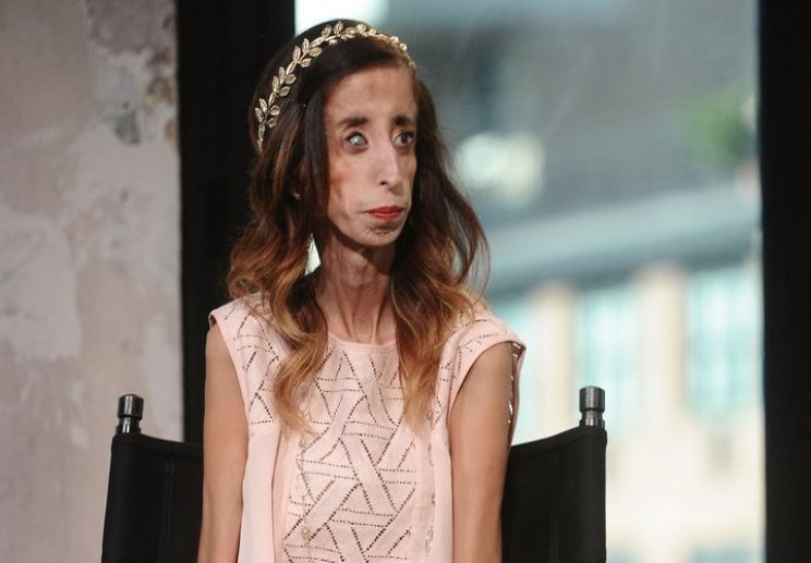 Lizzie Velasquez