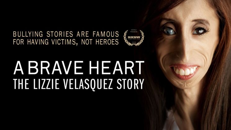 Lizzie Velasquez