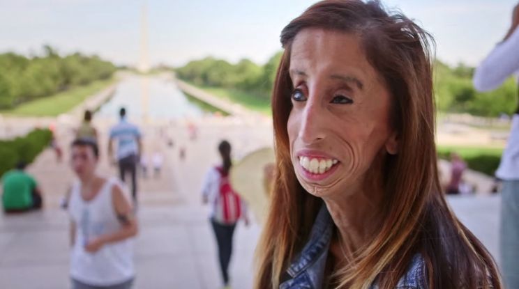 Lizzie Velasquez