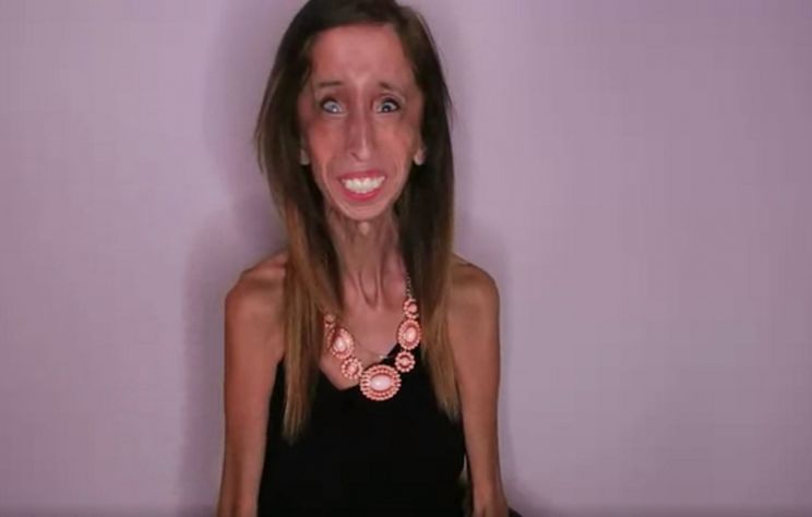 Lizzie Velasquez