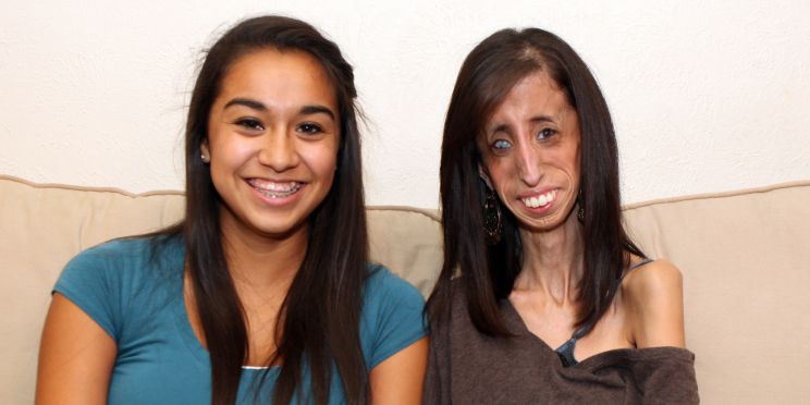 Lizzie Velasquez