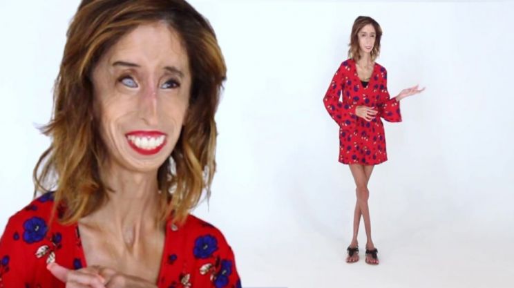 Lizzie Velasquez