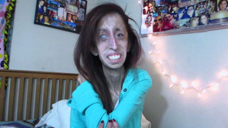 Lizzie Velasquez