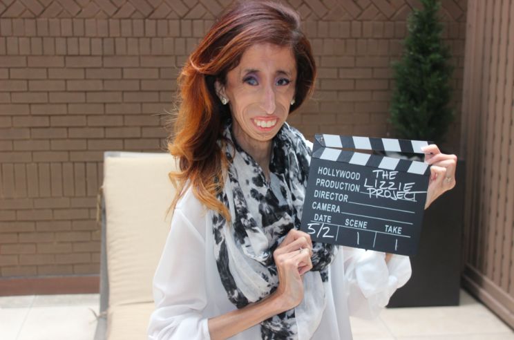 Lizzie Velasquez