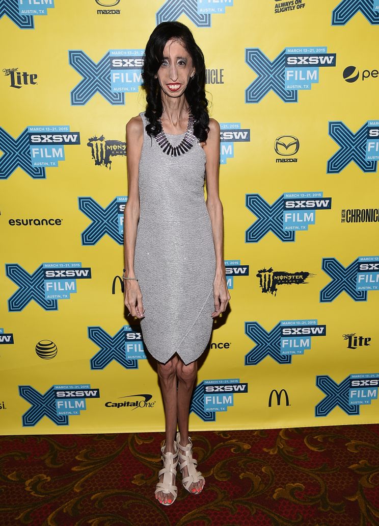 Lizzie Velasquez