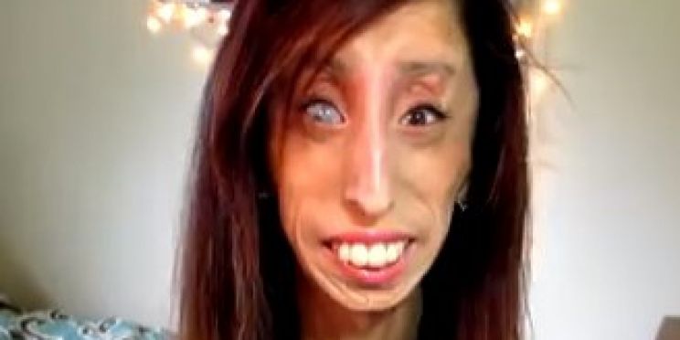 Lizzie Velasquez