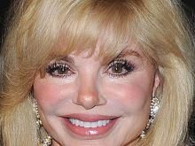 Loni Anderson