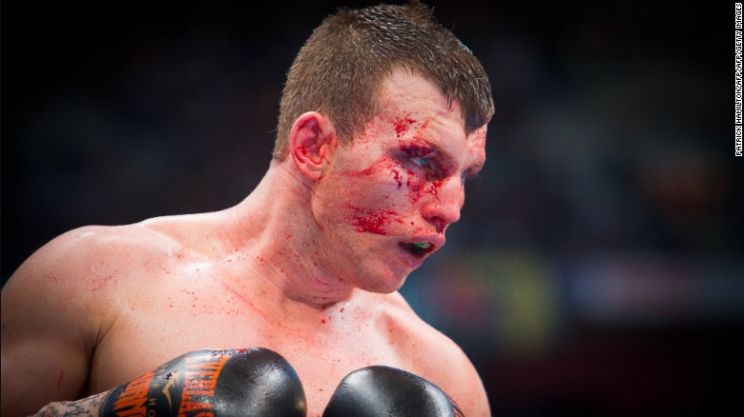 Manny Pacquiao
