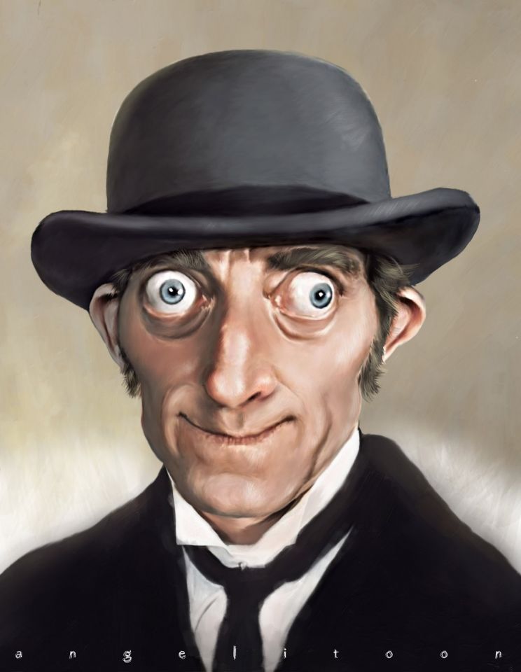 Marty Feldman