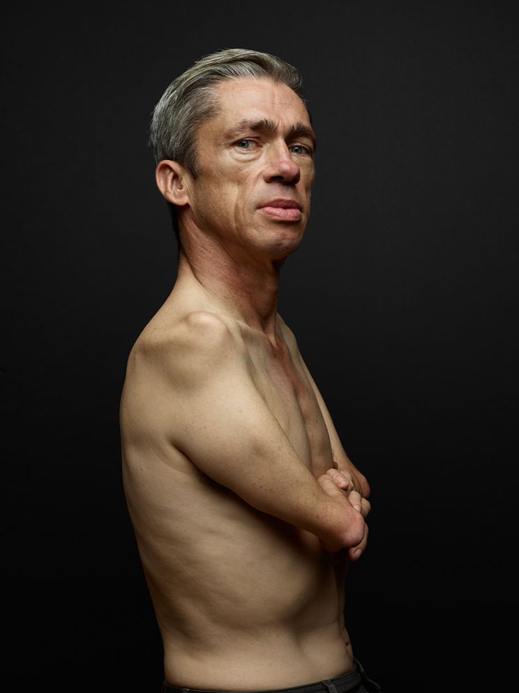 Mat Fraser