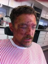 Matthew Lillard