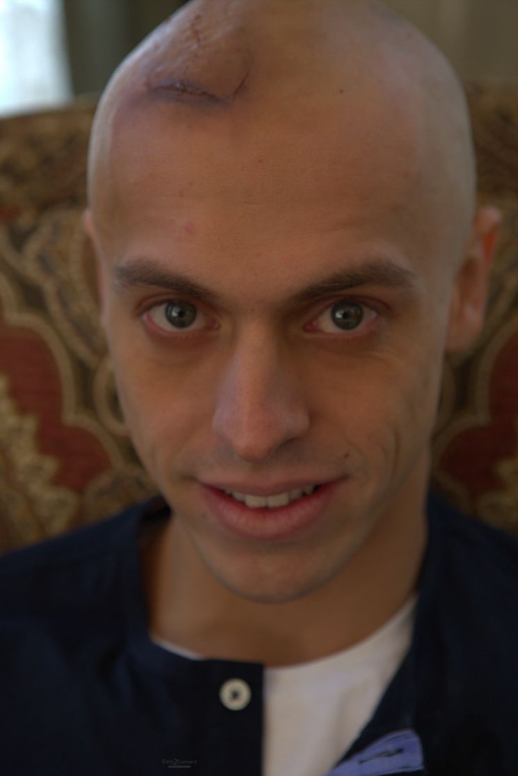 Metin Akdülger