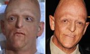 Michael Berryman