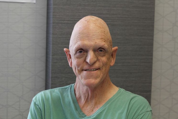 Michael Berryman