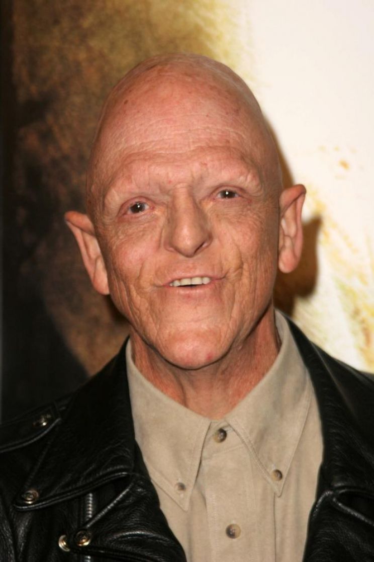 Michael Berryman