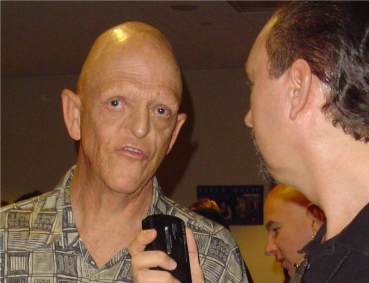 Michael Berryman