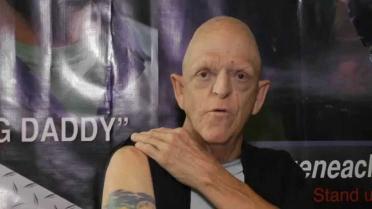 Michael Berryman