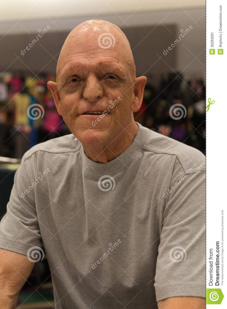 Michael Berryman