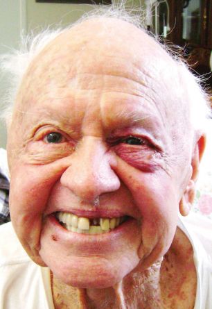 Mickey Rooney