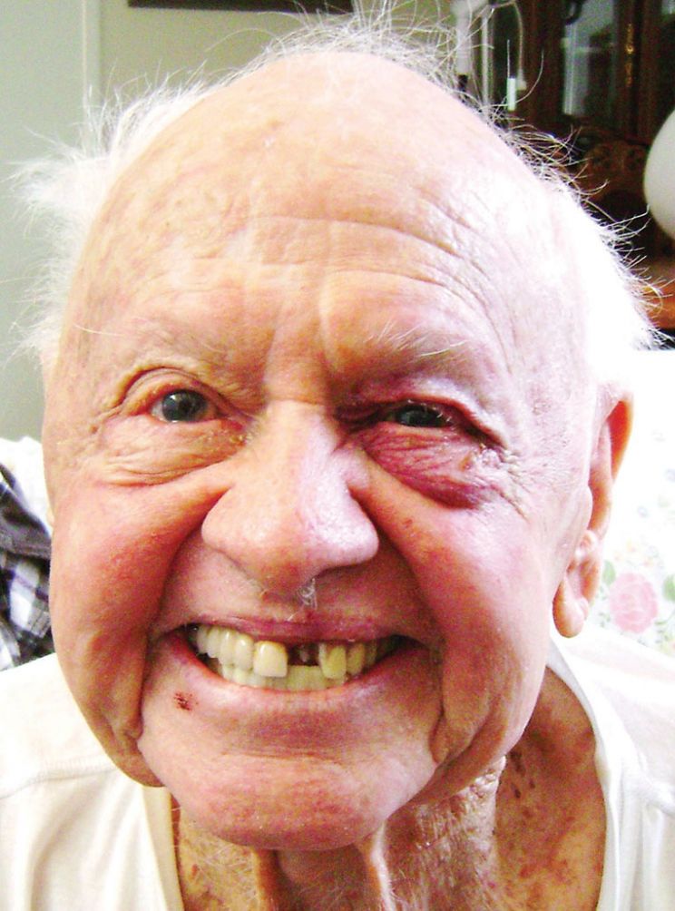 Mickey Rooney