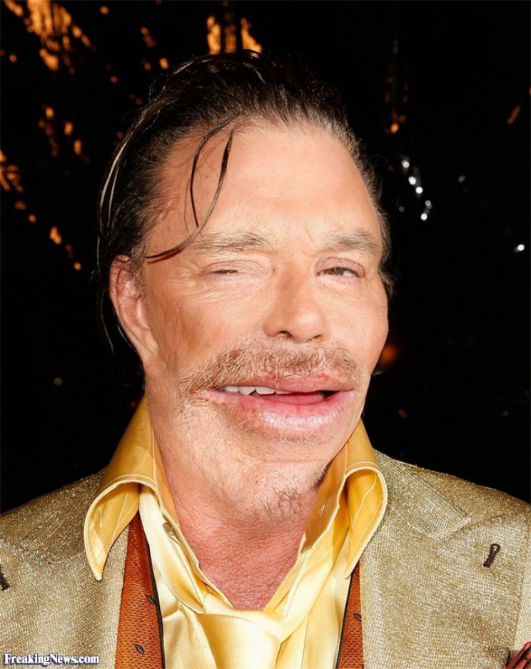 Mickey Rourke