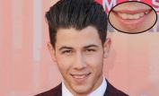 Nick Jonas