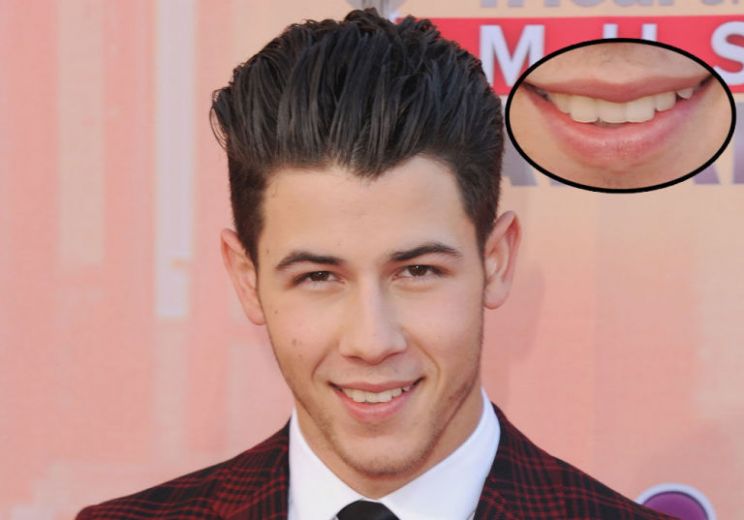 Nick Jonas