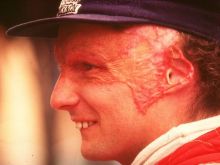 Niki Lauda