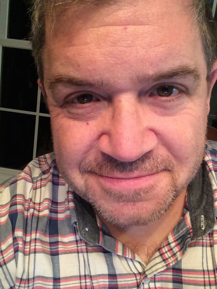 Patton Oswalt