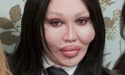 Pete Burns