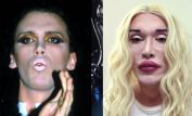 Pete Burns