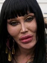 Pete Burns