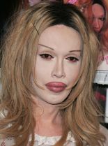 Pete Burns