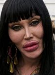 Pete Burns