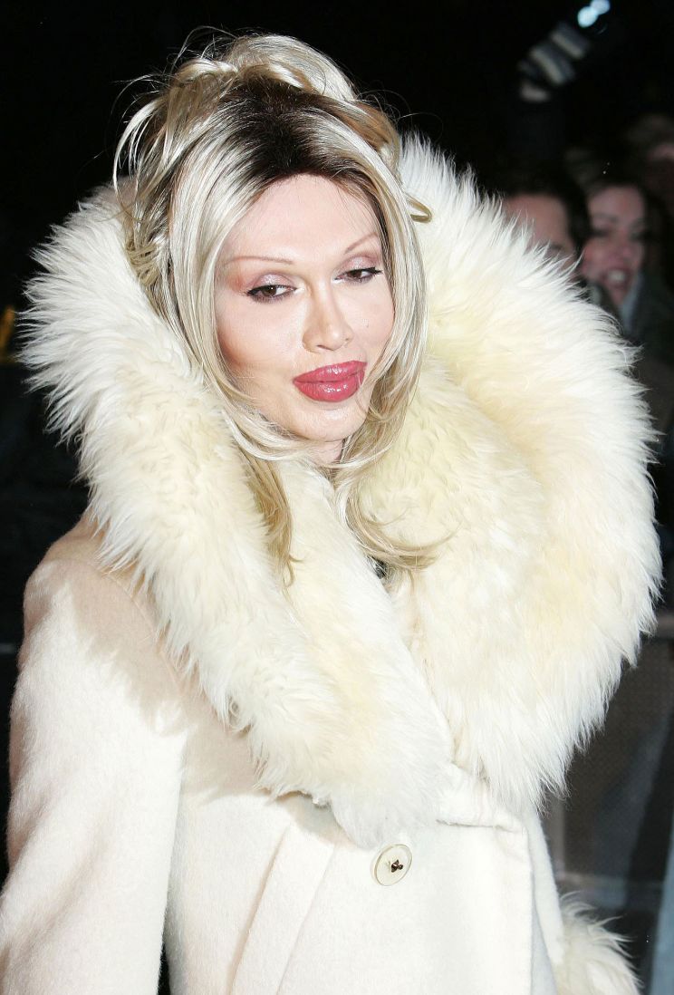 Pete Burns