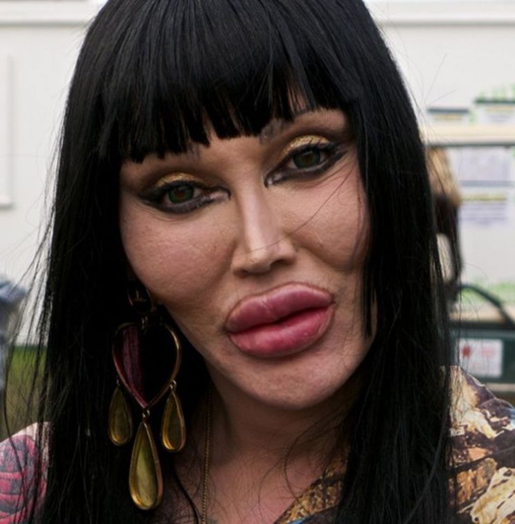 Pete Burns