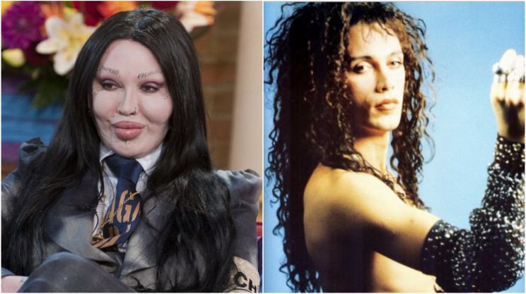 Pete Burns