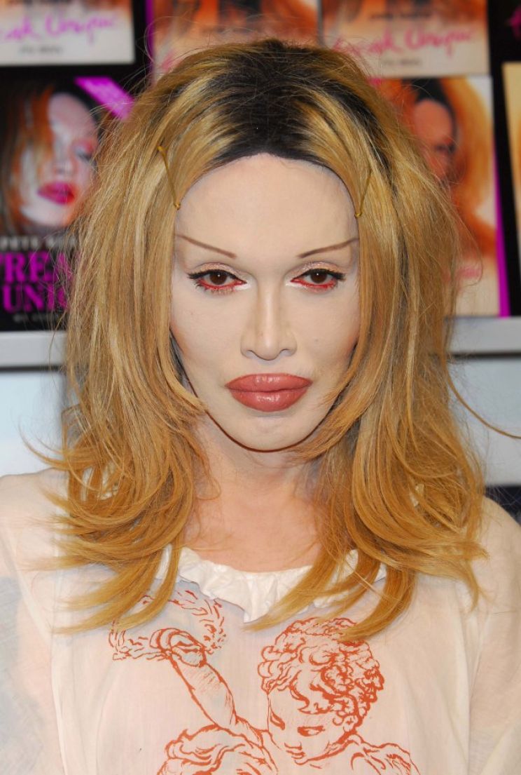 Pete Burns