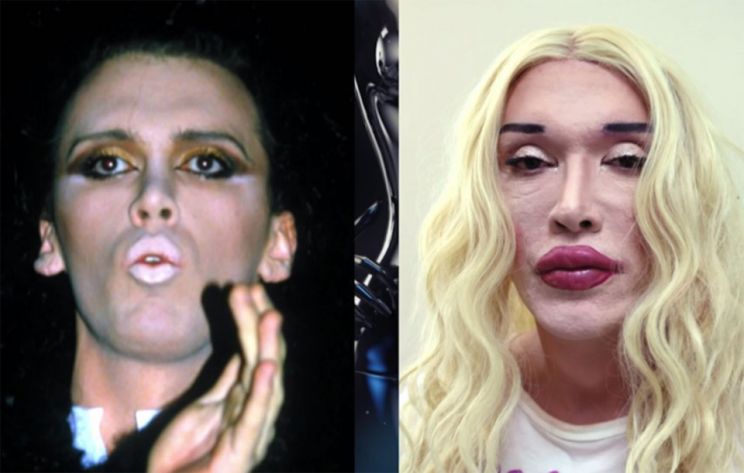 Pete Burns