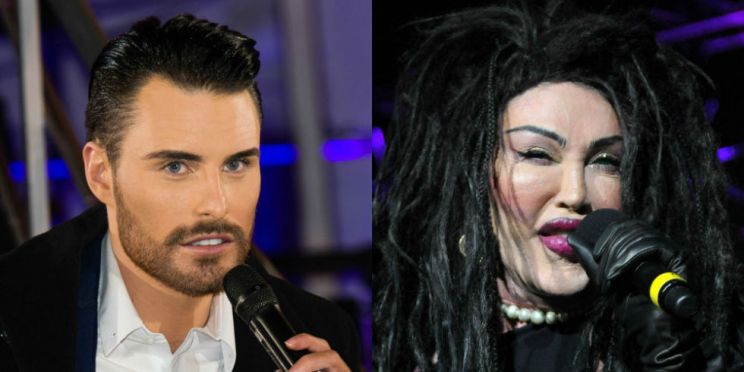 Pete Burns